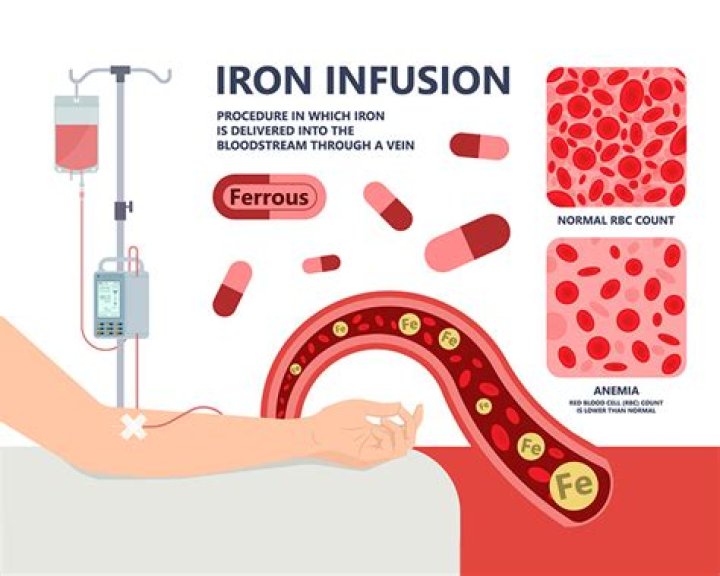 How does the mundane infusion work?